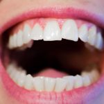 Korony zębowe – co to właściwie jest?