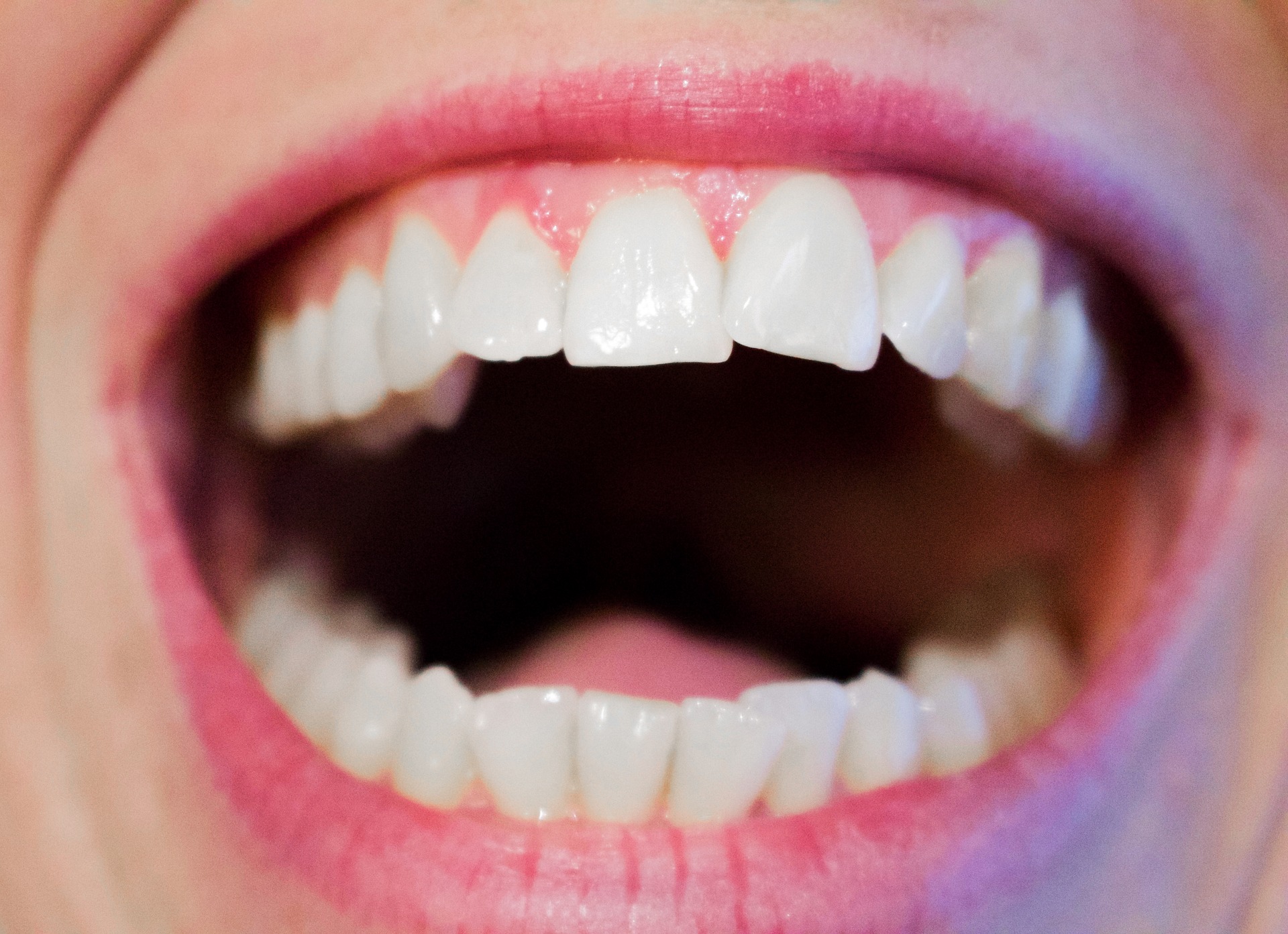 Korony zębowe – co to właściwie jest