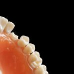 Jakie implanty stomatologiczne wybrać?