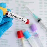 Cholesterol HDL i LDL – jakie są normy?