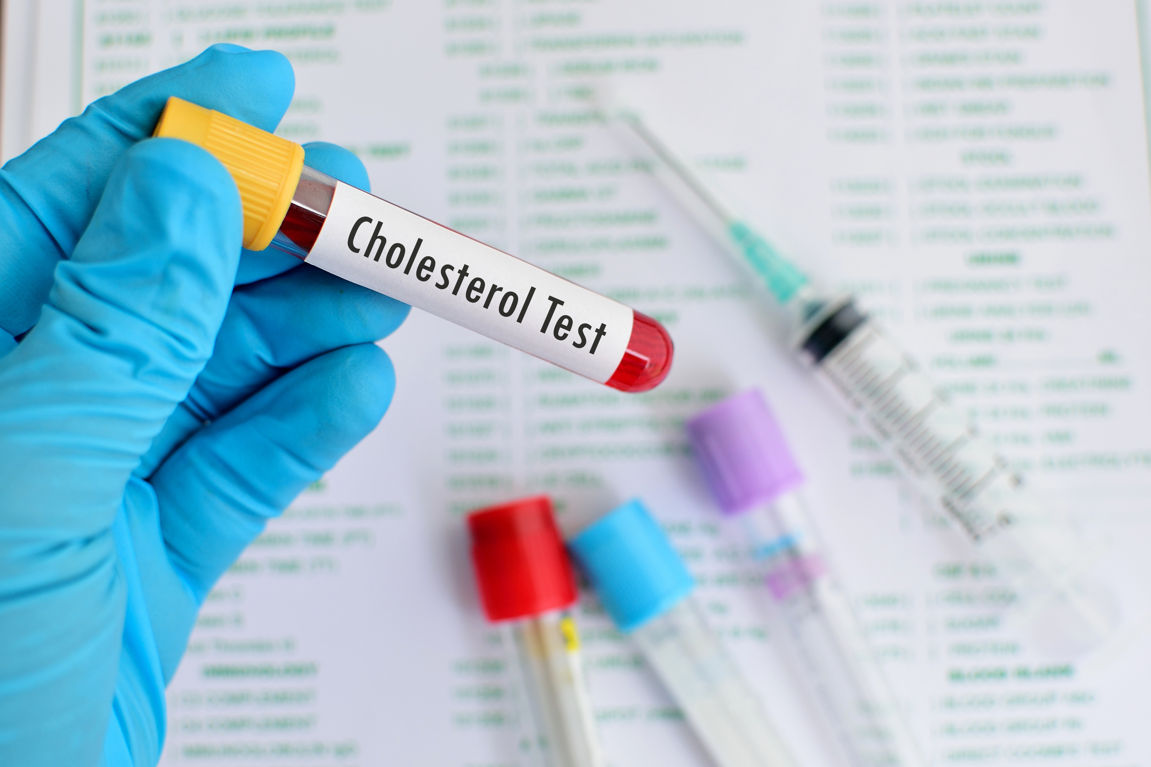 Cholesterol HDL i LDL – jakie są normy